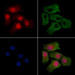 Phospho-mTOR (Ser2454) Antibody in Immunocytochemistry (ICC/IF)