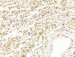 Phospho-mTOR (Ser2454) Antibody in Immunohistochemistry (Paraffin) (IHC (P))