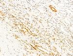 Phospho-mTOR (Ser2454) Antibody in Immunohistochemistry (Paraffin) (IHC (P))