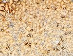 Phospho-mTOR (Ser2454) Antibody in Immunohistochemistry (Paraffin) (IHC (P))