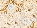 Phospho-mTOR (Ser2454) Antibody in Immunohistochemistry (Paraffin) (IHC (P))