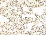 Phospho-mTOR (Ser2454) Antibody in Immunohistochemistry (Paraffin) (IHC (P))