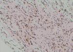 Phospho-mTOR (Ser2454) Antibody in Immunohistochemistry (Paraffin) (IHC (P))