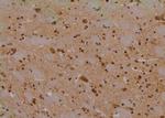 Phospho-mTOR (Ser2454) Antibody in Immunohistochemistry (Paraffin) (IHC (P))