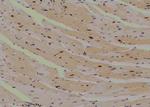 Phospho-MAPKAPK2 (Thr221, Thr222) Antibody in Immunohistochemistry (Paraffin) (IHC (P))