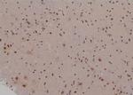 Phospho-TSC2 (Thr938) Antibody in Immunohistochemistry (Paraffin) (IHC (P))