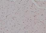 Phospho-TSC2 (Thr938) Antibody in Immunohistochemistry (Paraffin) (IHC (P))