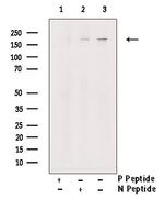 Phospho-TSC2 (Thr938) Antibody in Western Blot (WB)