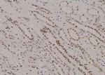 Phospho-CDK7 (Ser164) Antibody in Immunohistochemistry (Paraffin) (IHC (P))