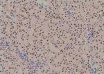 Phospho-CDK7 (Ser164) Antibody in Immunohistochemistry (Paraffin) (IHC (P))