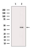 Phospho-CDK9 (Ser347) Antibody in Western Blot (WB)