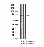 Phospho-PLK1 (Tyr217) Antibody in Western Blot (WB)