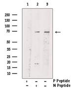 Phospho-PLK1 (Tyr217) Antibody in Western Blot (WB)