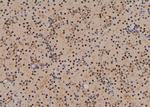 Phospho-CXCR4 (Ser338, Ser339) Antibody in Immunohistochemistry (Paraffin) (IHC (P))