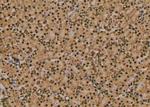 Phospho-RHOA (Thr100) Antibody in Immunohistochemistry (Paraffin) (IHC (P))