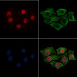 Phospho-CK2 alpha-1 (Tyr360) Antibody in Immunocytochemistry (ICC/IF)