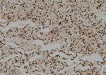 Phospho-CK2 alpha-1 (Tyr360) Antibody in Immunohistochemistry (Paraffin) (IHC (P))