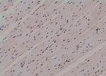 Phospho-CK2 alpha-1 (Tyr360) Antibody in Immunohistochemistry (Paraffin) (IHC (P))