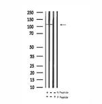 Phospho-PSD-95 (Ser142) Antibody in Western Blot (WB)