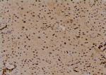 Phospho-PLCB3 (Ser1105) Antibody in Immunohistochemistry (Paraffin) (IHC (P))