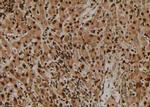 Phospho-TEK (Tyr897) Antibody in Immunohistochemistry (Paraffin) (IHC (P))