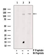 Phospho-TEK (Tyr897) Antibody in Western Blot (WB)