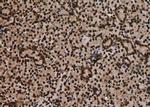 Phospho-Btk (Tyr223, Tyr225) Antibody in Immunohistochemistry (Paraffin) (IHC (P))