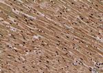 Phospho-Btk (Tyr223, Tyr225) Antibody in Immunohistochemistry (Paraffin) (IHC (P))