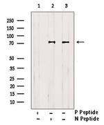 Phospho-Btk (Tyr223, Tyr225) Antibody in Western Blot (WB)