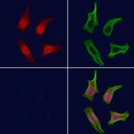 Phospho-Btk (Tyr344) Antibody in Immunocytochemistry (ICC/IF)