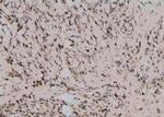 Phospho-Btk (Tyr344) Antibody in Immunohistochemistry (Paraffin) (IHC (P))