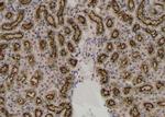 Phospho-Btk (Tyr344) Antibody in Immunohistochemistry (Paraffin) (IHC (P))