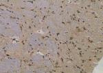 Phospho-Btk (Tyr344) Antibody in Immunohistochemistry (Paraffin) (IHC (P))