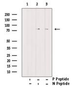 Phospho-Btk (Tyr344) Antibody in Western Blot (WB)