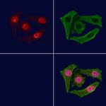 Phospho-MEF2C (Ser396) Antibody in Immunocytochemistry (ICC/IF)