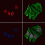 Phospho-MEF2C (Ser459) Antibody in Immunocytochemistry (ICC/IF)