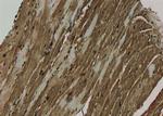 Phospho-PRDX1 (Ser196) Antibody in Immunohistochemistry (Paraffin) (IHC (P))