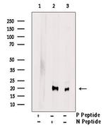 Phospho-PRDX1 (Ser196) Antibody in Western Blot (WB)