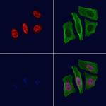 Phospho-FOXM1 (Thr600) Antibody in Immunocytochemistry (ICC/IF)