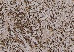 Phospho-Acetyl-CoA Carboxylase (Thr1196) Antibody in Immunohistochemistry (Paraffin) (IHC (P))