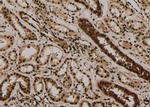 Phospho-4EBP1 (Thr45) Antibody in Immunohistochemistry (Paraffin) (IHC (P))