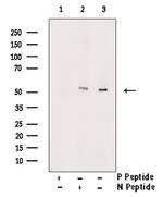 Phospho-RUNX2 (Ser275) Antibody in Western Blot (WB)