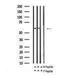 Phospho-RUNX2 (Ser275) Antibody in Western Blot (WB)