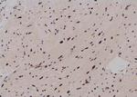 Phospho-RUNX2 (Ser28) Antibody in Immunohistochemistry (Paraffin) (IHC (P))