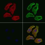 Phospho-GIT2 (Tyr393) Antibody in Immunocytochemistry (ICC/IF)