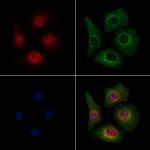 Phospho-Beclin 1 (Ser90, Ser93, Ser96) Antibody in Immunocytochemistry (ICC/IF)