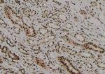 Phospho-Beclin 1 (Ser90, Ser93, Ser96) Antibody in Immunohistochemistry (Paraffin) (IHC (P))