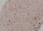 Phospho-Beclin 1 (Ser90, Ser93, Ser96) Antibody in Immunohistochemistry (Paraffin) (IHC (P))