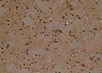 Phospho-Beclin 1 (Ser90, Ser93, Ser96) Antibody in Immunohistochemistry (Paraffin) (IHC (P))