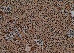 Phospho-IRF3 (Ser14) Antibody in Immunohistochemistry (Paraffin) (IHC (P))